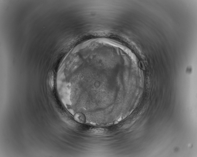 X0000098170069200805151127