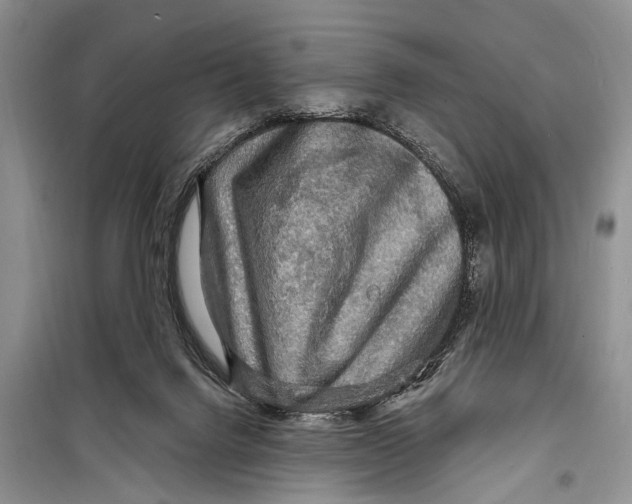 X0000098170072200805151127