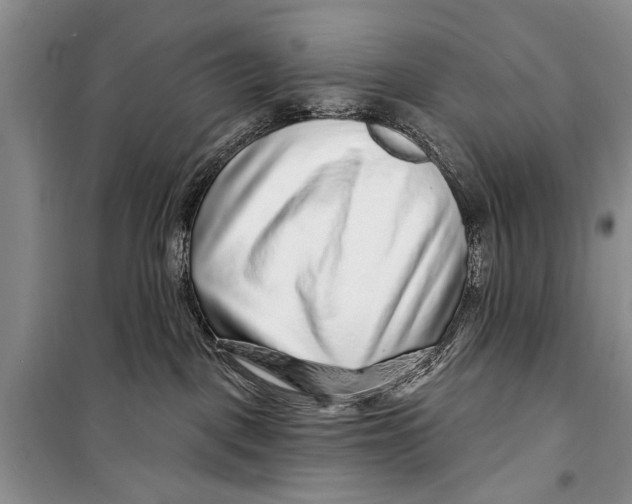 X0000098170093200805151127