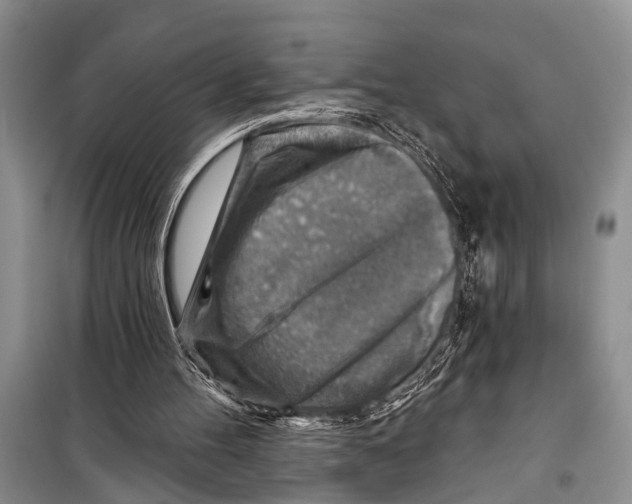 X0000098170100200805151126