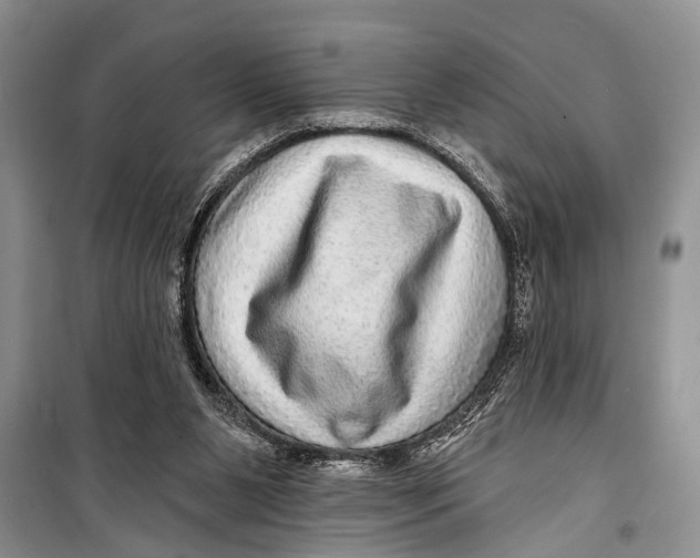 X0000098170111200805151126