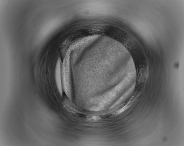 X0000098170140200805151126