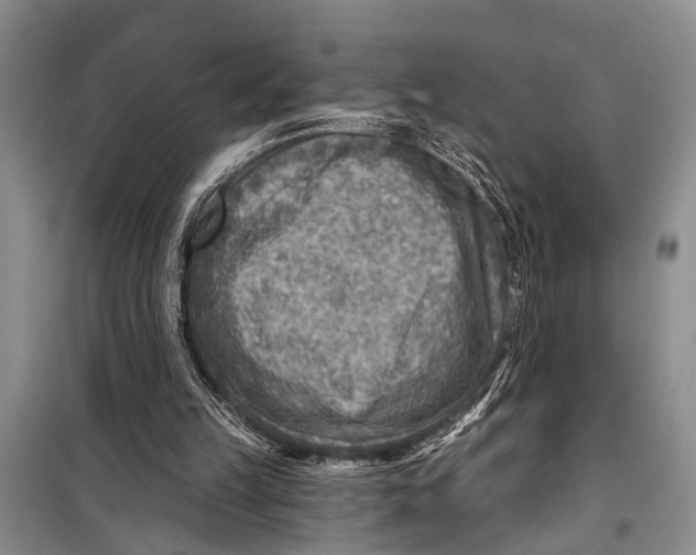 X0000098170149200805151125