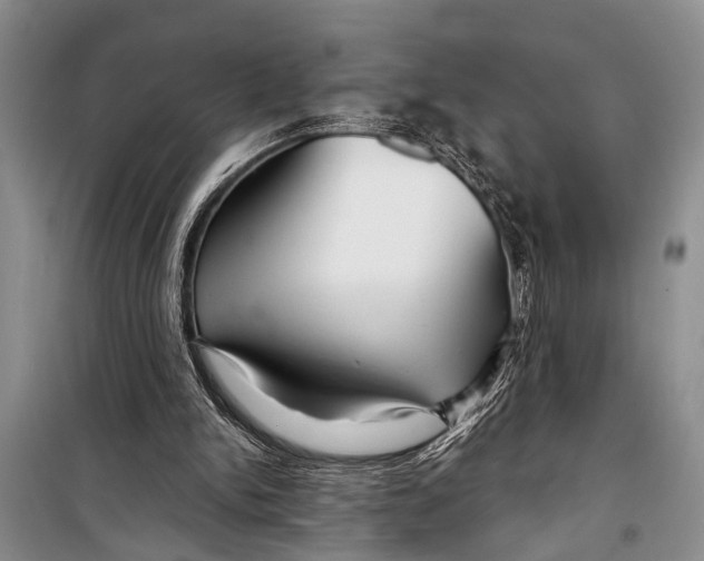 X0000098170150200805151125