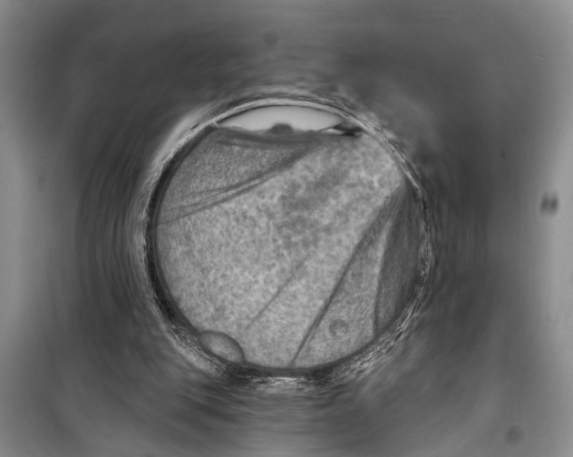 X0000098170151200805151125