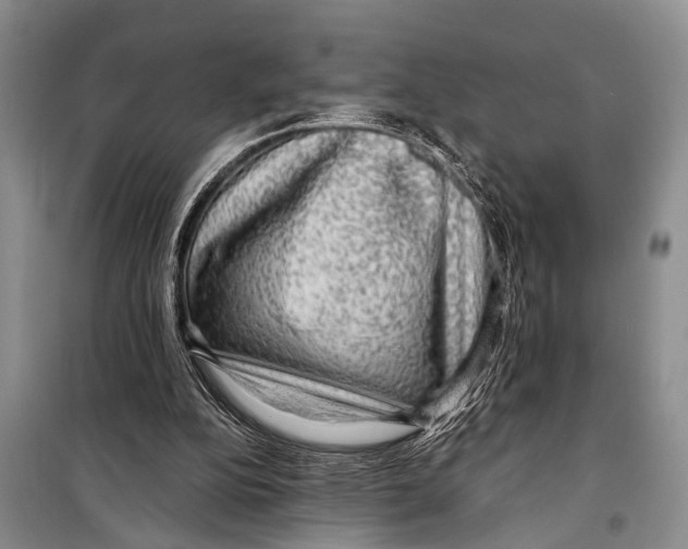 X0000098170152200805151125