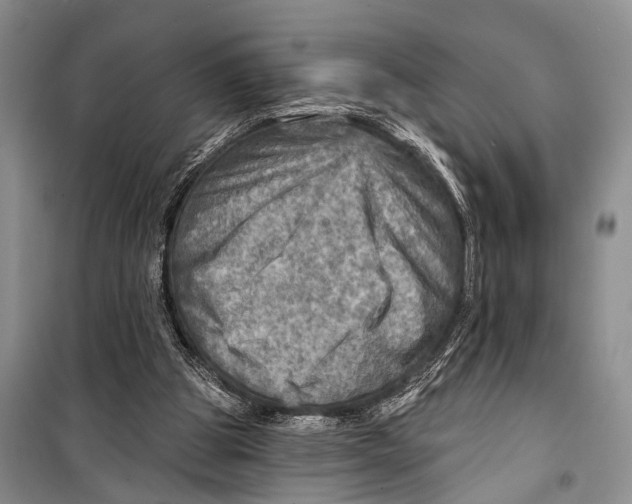 X0000098170153200805151125