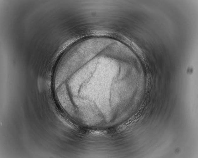 X0000098170155200805151125