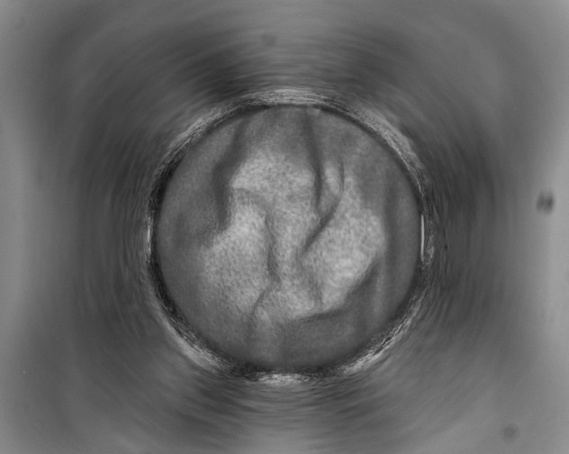 X0000098170157200805151125