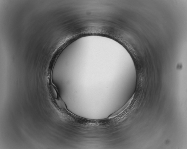 X0000098170160200805151125