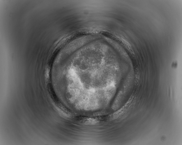 X0000098170166200805151125