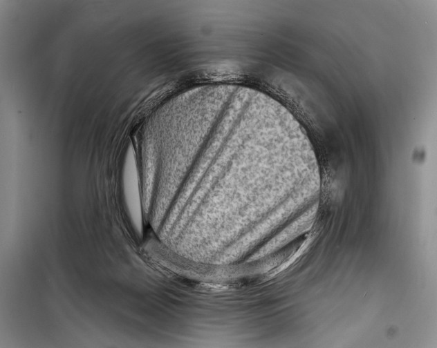 X0000098170170200805151125