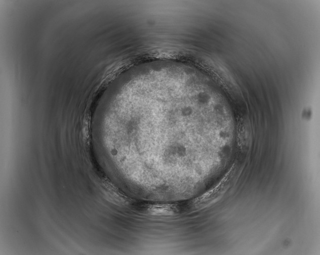 X0000098170175200805151125