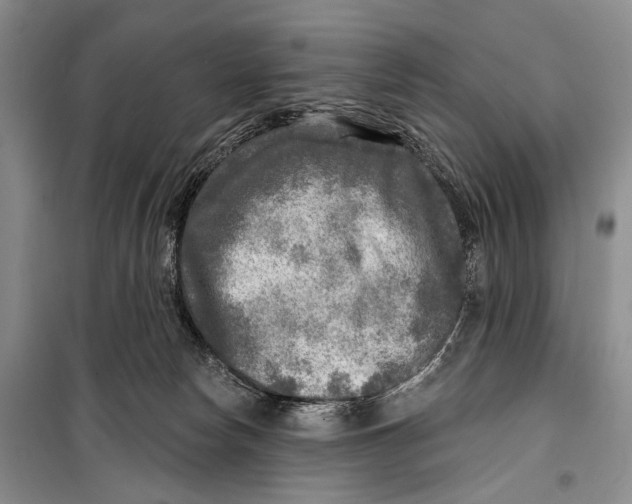 X0000098170178200805151125