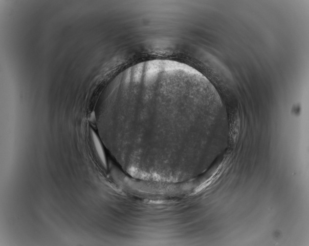 X0000098170180200805151125