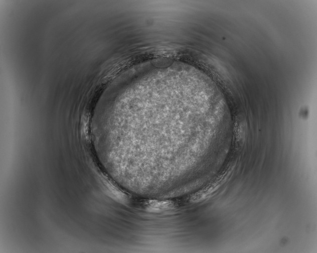 X0000098170185200805151125