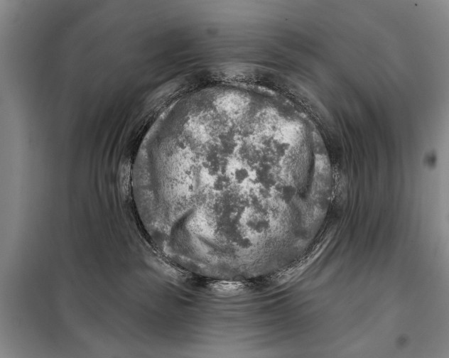 X0000098170189200805151125