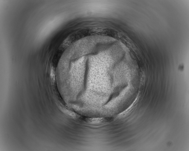 X0000098170191200805151125