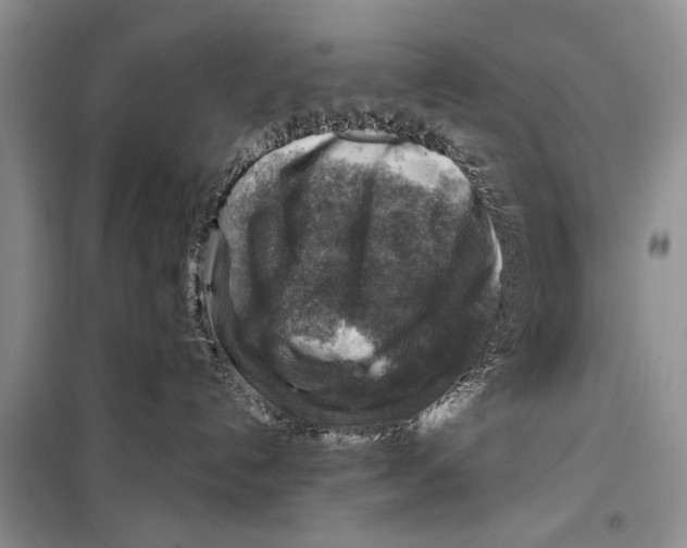 X0000098170192200805151125