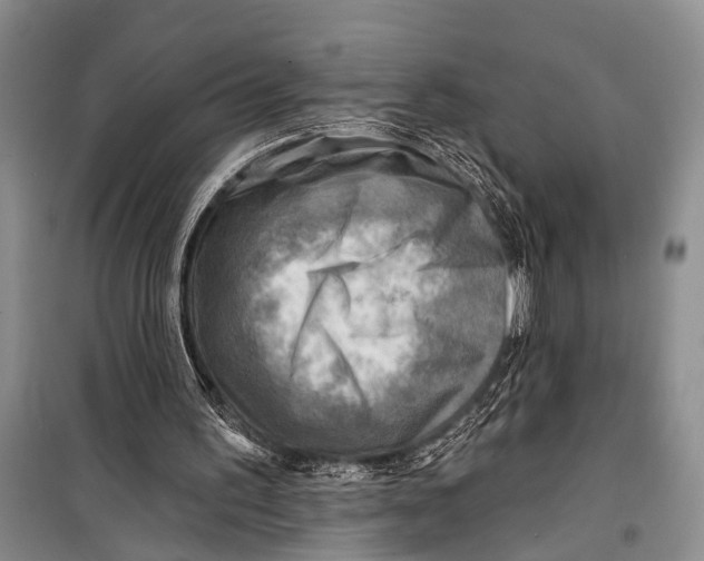 X0000098170195200805151125