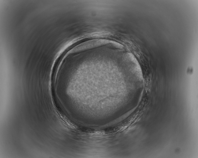 X0000098170196200805151125