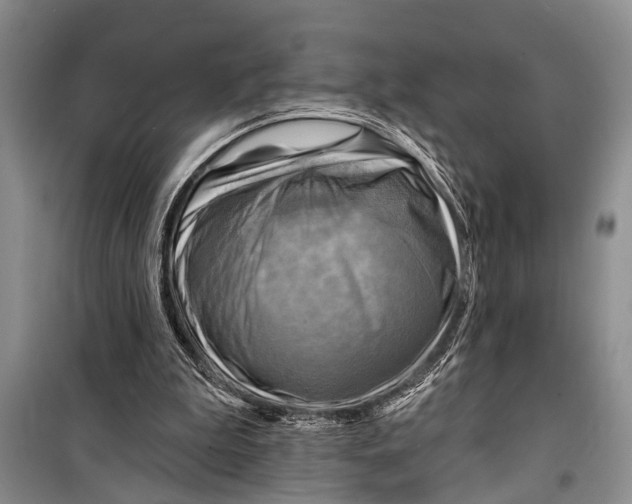 X0000098170199200805151125