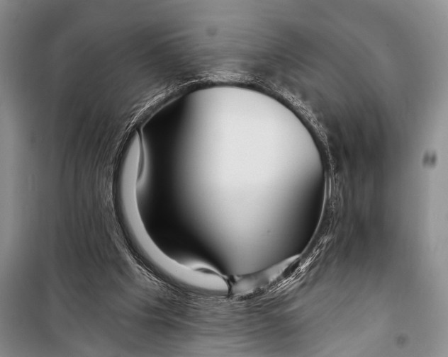 X0000098170201200805151125