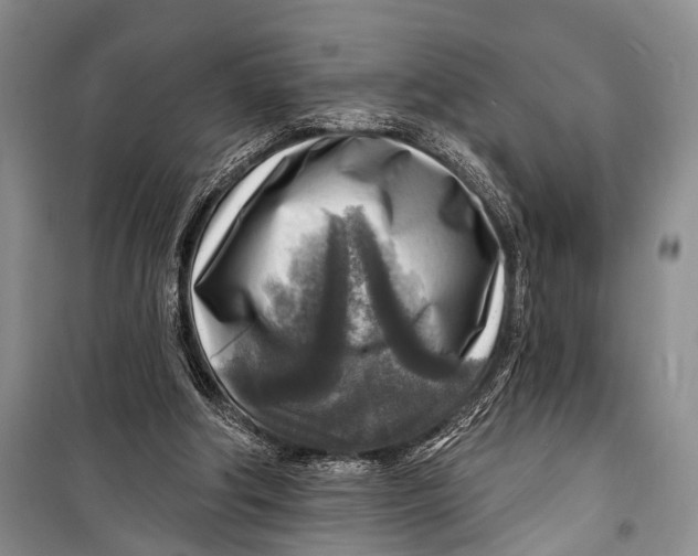 X0000098170202200805151124