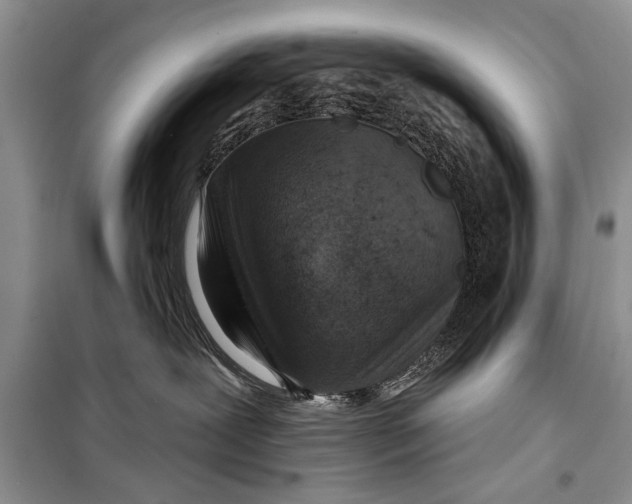 X0000098170239200805151124