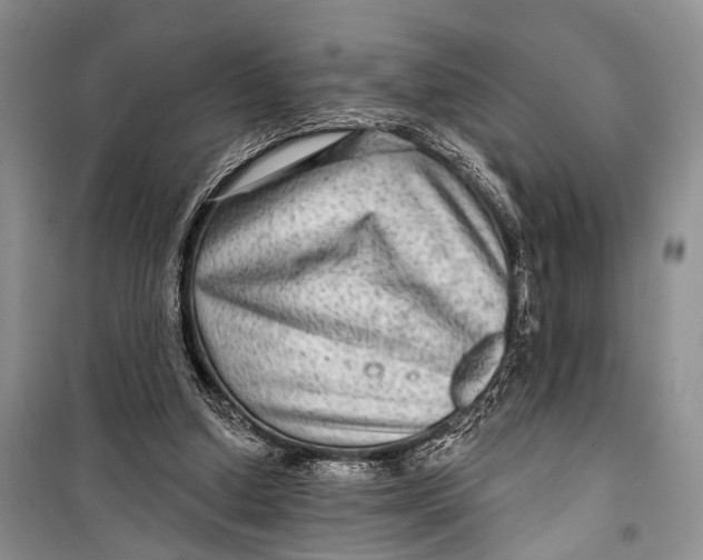 X0000098170250200805151123