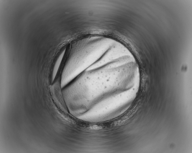 X0000098170257200805151123