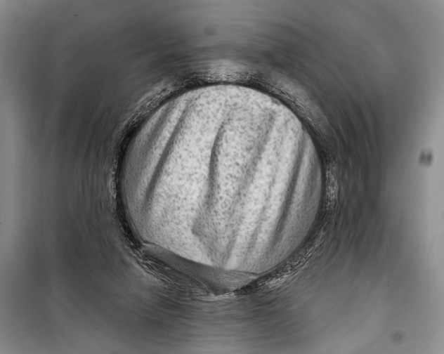 X0000098170258200805151123