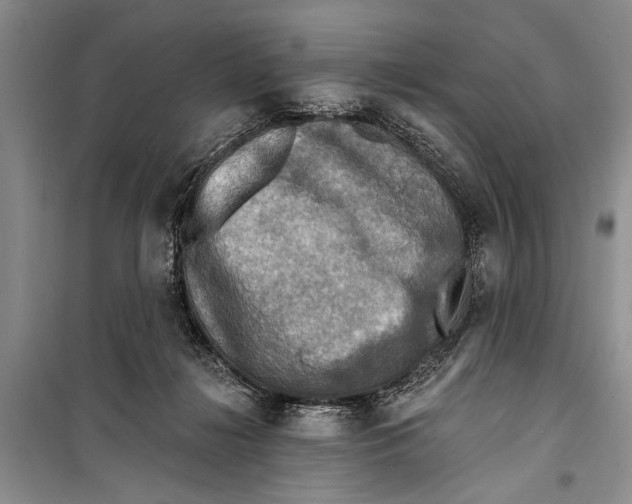 X0000098170268200805151124