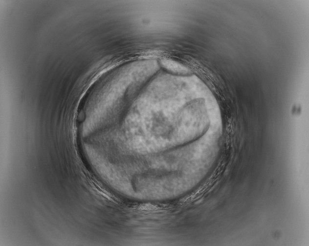 X0000098170290200805151123