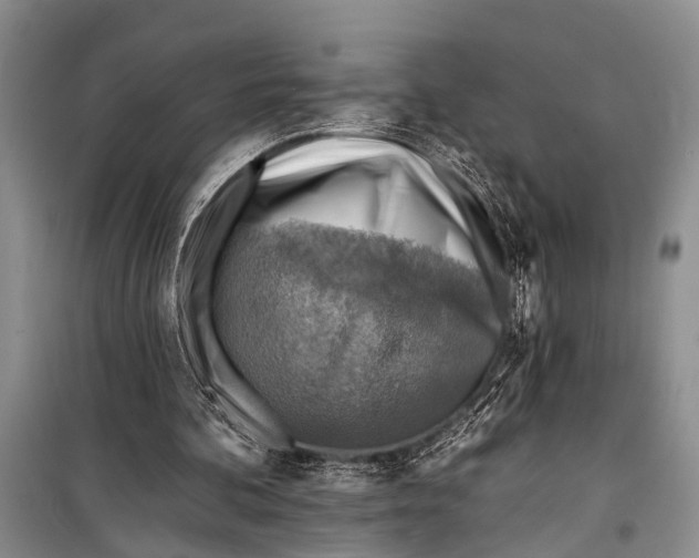 X0000098170292200805151123