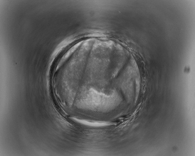 X0000098170296200805151123