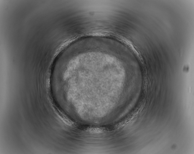 X0000098170299200805151123