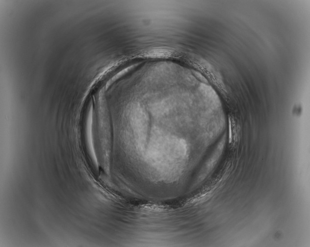 X0000098170300200805151123