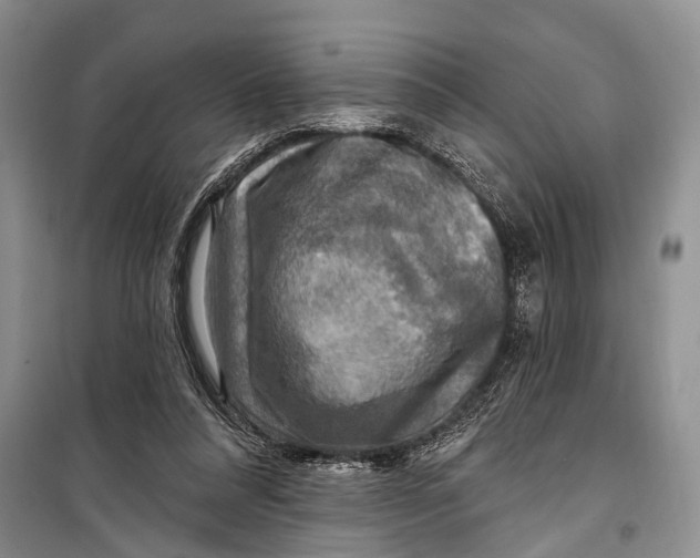 X0000098170304200805151123