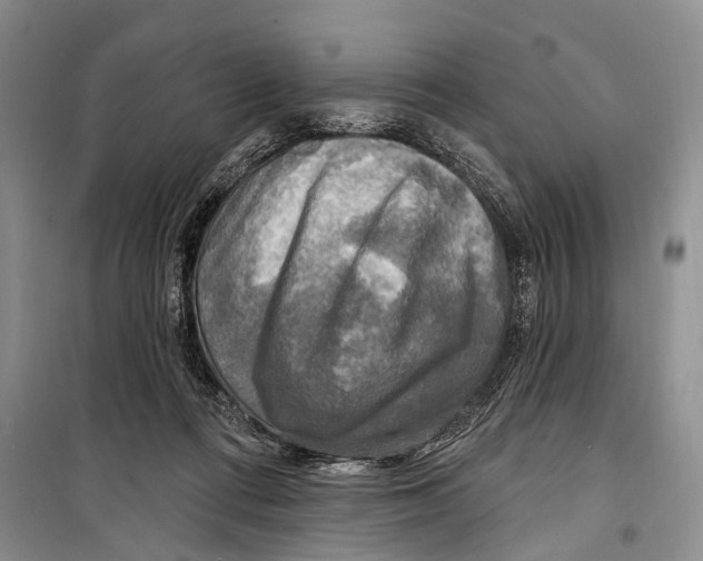 X0000098170312200805151123