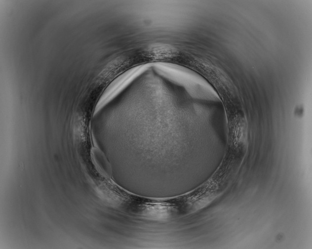 X0000098170316200805151123