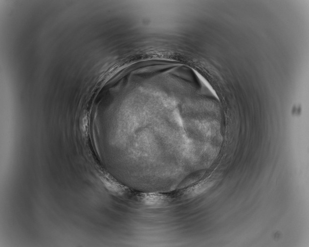 X0000098170336200805151122