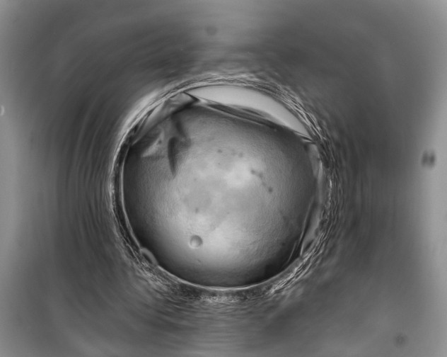 X0000098170340200805151122