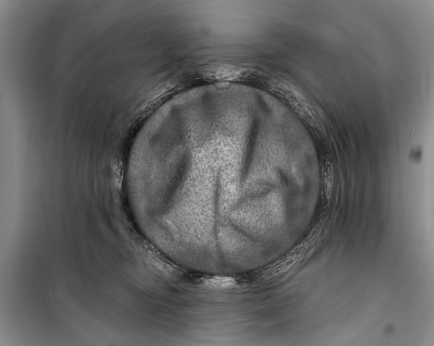 X0000098170374200805151122