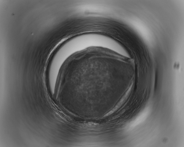 X0000098170387200805151121