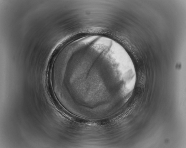 X0000098170392200805151121