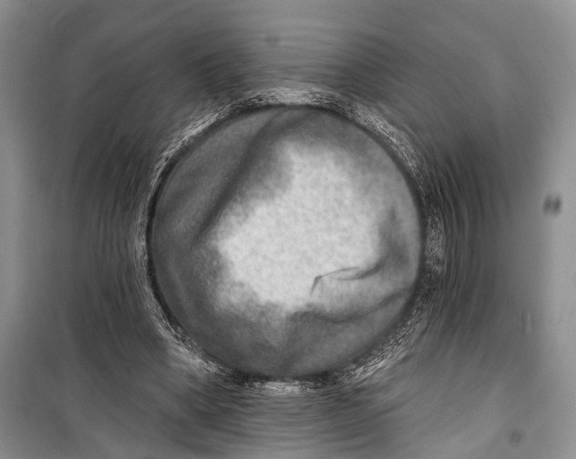 X0000098170394200805151121