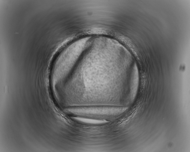 X0000098170395200805151121