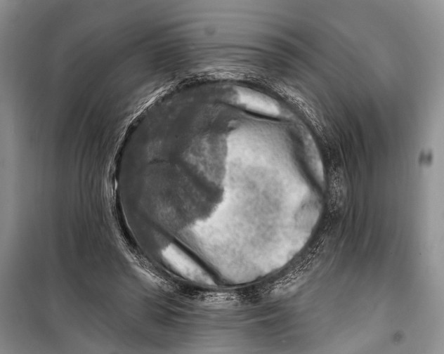 X0000098170398200805151121