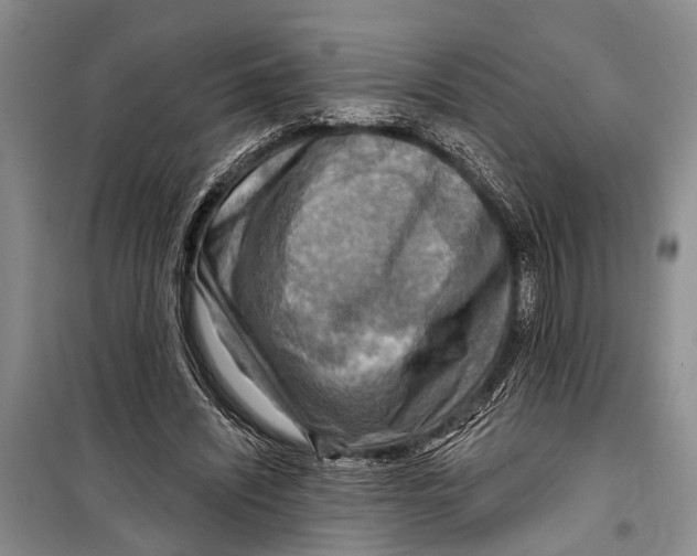 X0000098170444200805151120